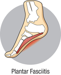 What are the best shoes for plantar fasciitis