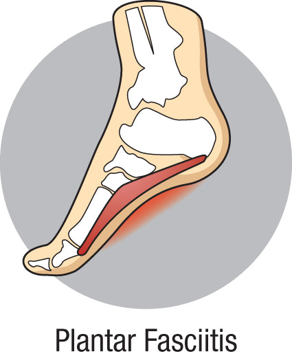 What are the best shoes for plantar fasciitis